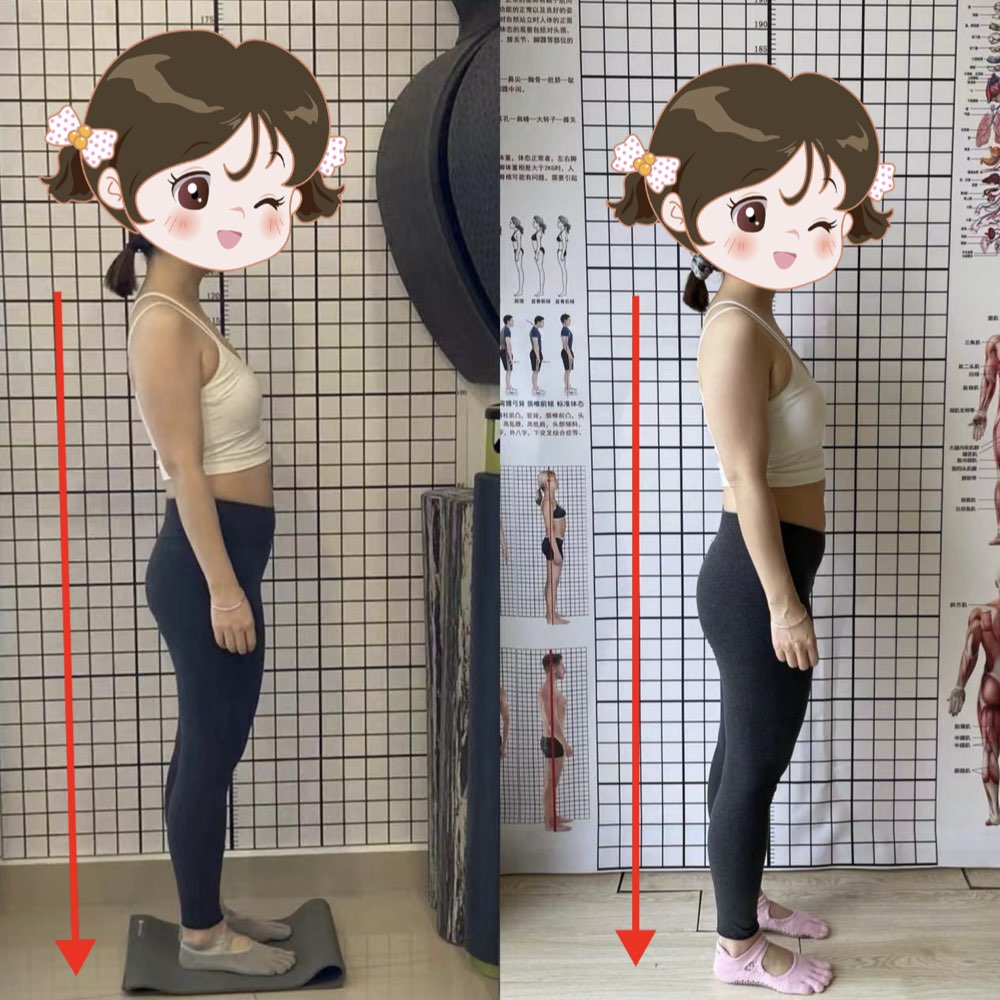pelvic tilt